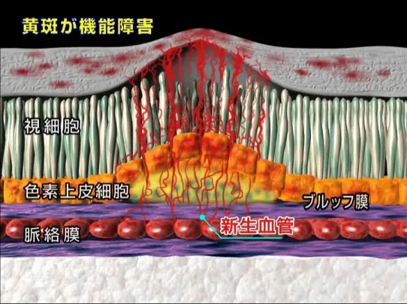 注射前の網膜断面図