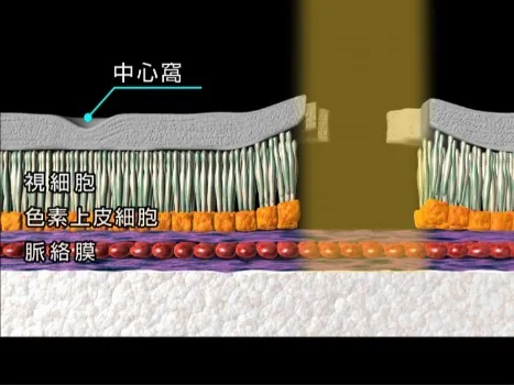 網膜断面図