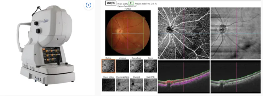 OCT、OCT-A、眼底写真：DRI OCT Triton