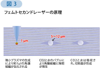 図3 フェムトセカンドレーザーの原理